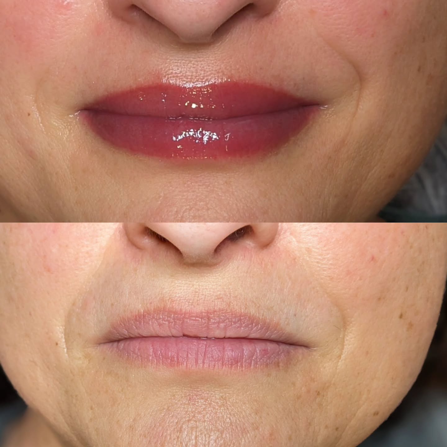 Vorher-Nachher-Vergleich einer Lippenpigmentierung.